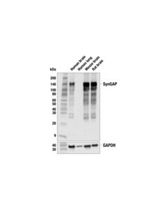 Cell Signaling SynGAP (E7J9K) Mouse mAb 20 uL