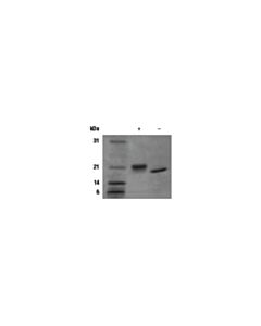 Cell Signaling Human Lif Recombinant Protein