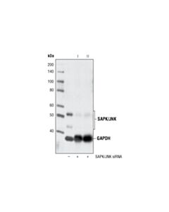Cell Signaling Signalsilence Sapk/Jnk Sirna I