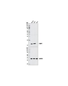 Cell Signaling Fatty Acid Binding Protein Antibody Sampler Kit