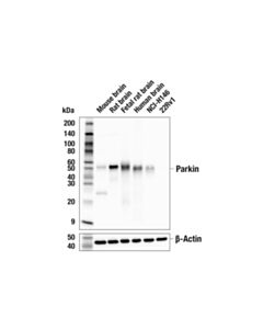 Cell Signaling Parkin (E6B1P) Mouse mAb 20 uL
