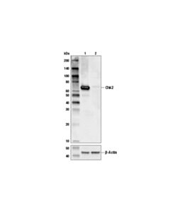 Cell Signaling Chk2 (D9c6) Xp Rabbit mAb