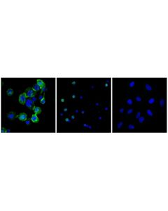 Cell Signaling CD11b/ITGAM (F2V1P) Mouse mAb