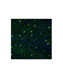 Cell Signaling Parvalbumin (E8N2U) XP ® Horse Chimeric mAb