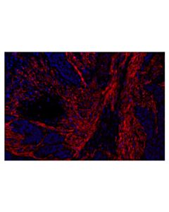Cell Signaling FAP (F1A4G) Rabbit Monoclonal Antibody (Alexa Fluor ® 647 Conjugate)