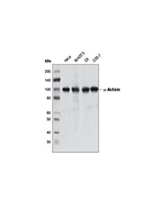 Cell Signaling Alpha-Actinin (D6f6) Xp Rabbit mAb