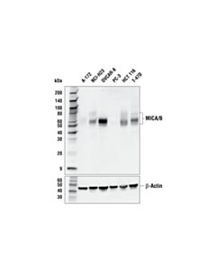 Cell Signaling MICA/B (E9N7G) Rabbit mAb 20 uL