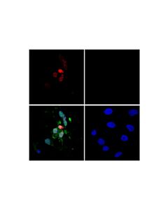Cell Signaling Tunel Assay Kit (Fluorescence, 640 Nm)