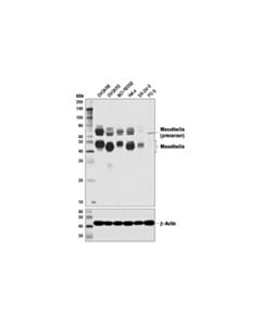 Cell Signaling Mesothelin (D4x7m) Rabbit mAb