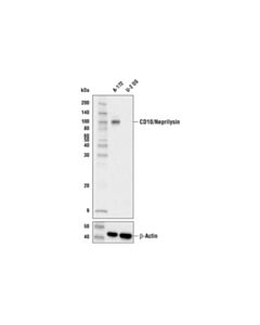 Cell Signaling Cd10/Neprilysin (E5p7s) Rabbit mAb