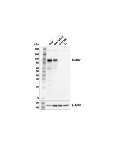 Cell Signaling ADAR2 (F6U8S) Rabbit mAb