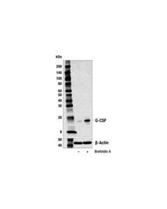 Cell Signaling g-CSF (E9S2E) Rabbit mAb 20 uL