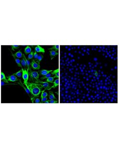 Cell Signaling Nestin (F3Y7S) Mouse mAb