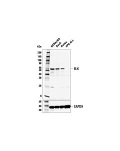 Cell Signaling Blk (E8t1b) Rabbit mAb