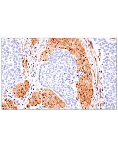 Cell Signaling PPP1R14A/CPI-17 (F1I6X) Rabbit Monoclonal Antibody