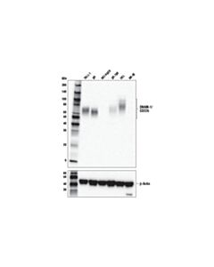 Cell Signaling Dnam-1/Cd226 (E8l9g) Xp Rabbit mAb