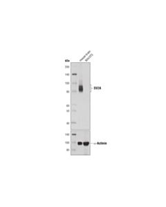 Cell Signaling SV2A (D1L8S) Rabbit mAb 20 uL
