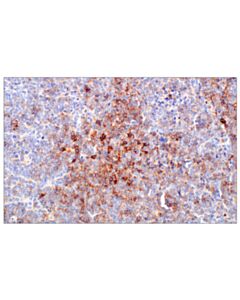 Cell Signaling CXCR4 (F1K2M) Rabbit mAb