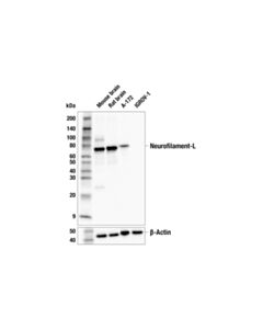 Cell Signaling Neurofilament-L (E4Z2P) Mouse mAb 20 uL