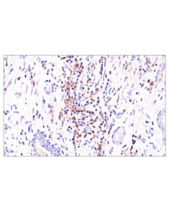 Cell Signaling Dnam-1/Cd226 (E8l9g) Xp® Rabbit mAb (BSA And Azide Free)