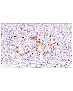 Cell Signaling ICOS (E5F7E) Rabbit mAb 20 uL