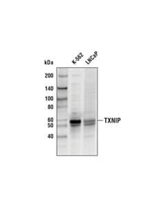 Cell Signaling Txnip (D5f3e) Rabbit mAb (Biotinylated)