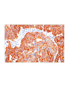 Cell Signaling Pan-Keratin (AE1/AE3) Mouse mAb
