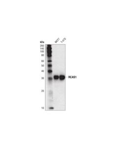 Cell Signaling RCAS1 (D8K2E) Mouse mAb 20 uL