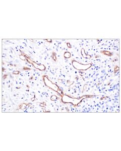 Cell Signaling CD105/Endoglin (F9C5Q) Rabbit mAb