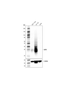Cell Signaling Gitr (D9i9d) Rabbit mAb (Ihc Preferred)
