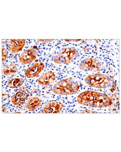 Cell Signaling CA 19-9 (C241:5:1:4) Mouse mAb