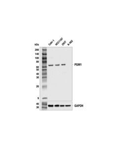 Cell Signaling Pgm1 (E2i5g) Rabbit mAb