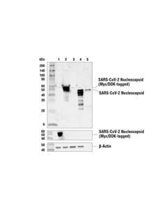 Cell Signaling Sars-Cov-1/2 Nucleocapsid Protein (1c7c7) Mouse mAb