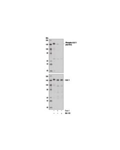 Cell Signaling Phospho-Ulk1 (Ser757) Antibody