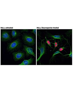 Cell Signaling Cleaved Parp (Asp214) (D64e10) Xp Rabbit mAb (Alexa Fluor 555 Conjugate)