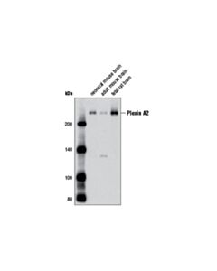 Cell Signaling Plexin A2 (D44d4) Rabbit mAb