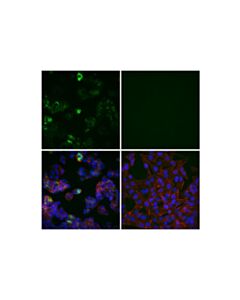 Cell Signaling Neurofilament-H (E9C9Z) Mouse mAb 20 uL