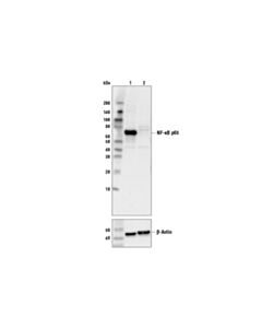 Cell Signaling Nf-Kappab P65 (L8f6) Mouse mAb