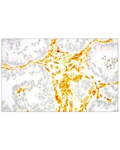 Cell Signaling Signalstain Radiant Yellow Peroxidase Substrate Kit