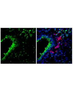 Cell Signaling YKL-40 (F9N3K) Rabbit mAb; 20 µl