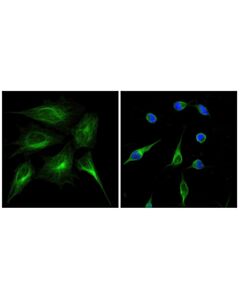 Cell Signaling Cleaved Parp (Asp214) (D64e10) Xp Rabbit mAb (Alexa Fluor 647 Conjugate)
