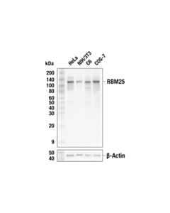 Cell Signaling RBM25 (F9X4K) Rabbit mAb