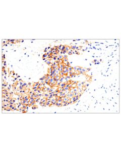 Cell Signaling Epha2 (D4a2) Xp Rabbit mAb
