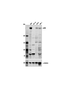 Cell Signaling p300 (D1M7C) Rabbit mAb 20 uL
