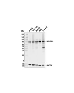 Cell Signaling Ndufs1 (E4k3e) Rabbit mAb