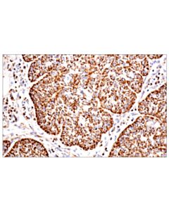 Cell Signaling Tspo (D1n7z) Rabbit mAb