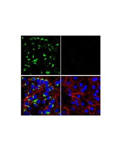 Cell Signaling Furin (E1w4o) Rabbit mAb