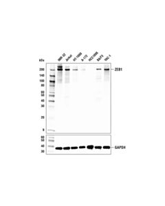 Cell Signaling Zeb1 (E2g6y) Xp Rabbit mAb