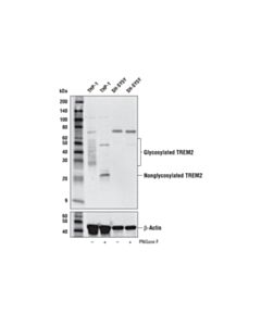 Cell Signaling TREM2 (E9U8L) Rabbit mAb (Amino-terminal Antigen) 20 uL