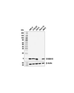 Cell Signaling S100A10 (F9U2Z) Rabbit mAb